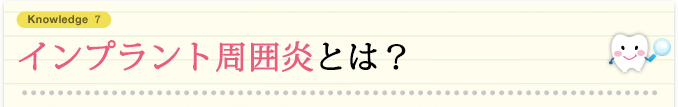インプラント周囲炎とは？